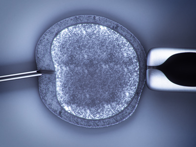 in vitro